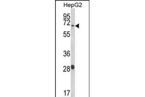 Western blot analysis of WAC Antibody (Center) (ABIN653490 and ABIN2842908) in HepG2 cell line lysates (35 μg/lane). (WAC anticorps  (AA 284-313))