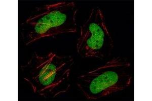 Fluorescent image of HeLa cell stained with HDAC1 antibody at 1:25.