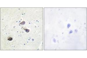 Immunohistochemistry analysis of paraffin-embedded human brain tissue, using KOR-1 (Ab-369) Antibody.