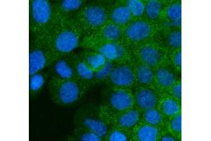 IF analysis of IGF2R using anti-IGF2R antibody (ABIN5693085). (IGF2R anticorps  (AA 424-529))