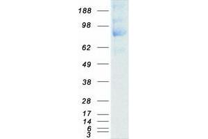 Validation with Western Blot