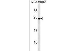 TRDC Antibody (Center) (ABIN1538630 and ABIN2838134) western blot analysis in MDA-M cell line lysates (35 μg/lane). (TRDC anticorps  (AA 79-106))