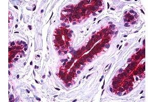 IHC Information: Paraffin embedded breast tissue, tested with an antibody dilution of 5 ug/ml. (SSBP2 anticorps  (N-Term))
