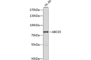 Western blot analysis of extracts of HL-60 cells using ABCG5 Polyclonal Antibody at dilution of 1:1000.