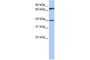 WB Suggested Anti-MPP5 Antibody Titration:  0. (MPP5 anticorps  (N-Term))
