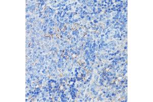 Immunohistochemistry of paraffin-embedded rat spleen using CR2/CD21 antibody (ABIN6132246, ABIN6138992, ABIN6138993 and ABIN6224458) at dilution of 1:100 (40x lens). (CD21 anticorps  (AA 300-590))
