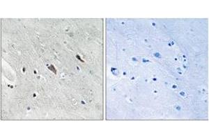 Immunohistochemistry analysis of paraffin-embedded human brain, using Gab2 (Phospho-Tyr643) Antibody.