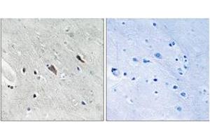 Immunohistochemistry analysis of paraffin-embedded human brain, using Gab2 (Phospho-Tyr643) Antibody. (GAB2 anticorps  (pTyr643))