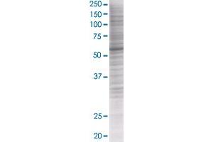 ZSCAN21 transfected lysate.