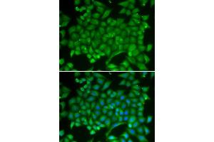 Immunofluorescence analysis of MCF-7 cell using RAB11A antibody. (RAB11A anticorps  (AA 1-216))