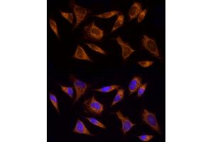 Immunofluorescence analysis of HeLa cells using  Rabbit pAb (ABIN6129864, ABIN6136458, ABIN6136459 and ABIN6222564) at dilution of 1:100 (40x lens).
