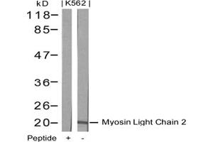 Image no. 2 for anti-Myosin, Light Chain 2, Regulatory, Cardiac, Slow (MYL2) (AA 16-20) antibody (ABIN197362) (MYL2 anticorps  (AA 16-20))