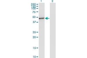 Western Blot analysis of MAPK8 expression in transfected 293T cell line by MAPK8 monoclonal antibody (M05), clone 4H5. (JNK anticorps  (AA 318-427))