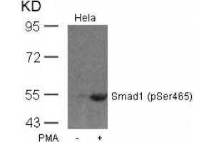 Image no. 1 for anti-SMAD, Mothers Against DPP Homolog 1 (SMAD1) (pSer465) antibody (ABIN319257) (SMAD1 anticorps  (pSer465))