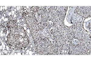 IHC analysis of MCM6 using anti-MCM6 antibody (ABIN7600036). (MCM6 anticorps  (AA 14-821))