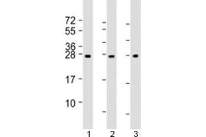 Western blot testing of human 1) human liver, 2) RPMI-8226 and 3) SH-SY5Y lysate with NT5M antibody at 1:2000. (NT5M anticorps  (AA 195-226))