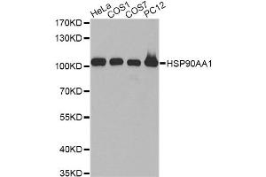 Western blot analysis of extracts of various cell lines, using HSP90AA1 antibody (ABIN6292999) at 1:500 dilution.