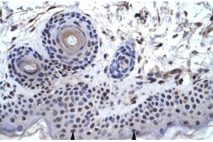Human Skin; ZNF660 antibody - C-terminal region in Human Skin cells using Immunohistochemistry (ZNF660 anticorps  (C-Term))