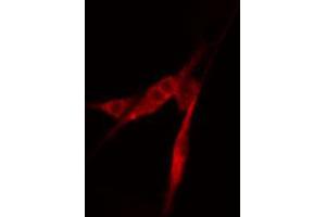 ABIN6274217 staining COLO205 cells by IF/ICC. (APEX1 anticorps  (N-Term))