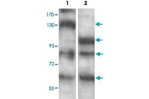 Western blot analysis of human fetal brain (Lane 1) and mouse brain (Lane 2) lysate with ADAMTS7 polyclonal antibody  at 1 : 500 dilution. (ADAMTS7 anticorps  (C-Term))