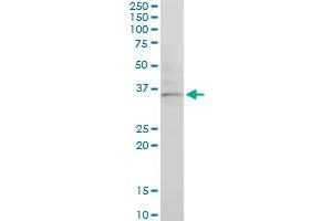 CHN1 monoclonal antibody (M03), clone 3A3.