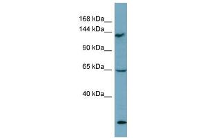 WB Suggested Anti-LATS1 Antibody Titration: 0.