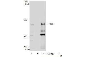 IP Image Immunoprecipitation of CSB protein from 293T whole cell extracts using 5 μg of CSB antibody [N2C1], Internal, Western blot analysis was performed using CSB antibody [N2C1], Internal, EasyBlot anti-Rabbit IgG  was used as a secondary reagent.