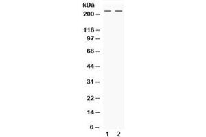 Western blot testing of human 1) HeLa and 2) HepG2 cell lysate with Nestin antibody.