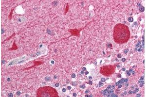 Human Brain, Cerebellum (formalin-fixed, paraffin-embedded) stained with AKAP7 antibody ABIN214084 at 5 ug/ml followed by biotinylated goat anti-rabbit IgG secondary antibody ABIN481713, alkaline phosphatase-streptavidin and chromogen. (AKAP7 anticorps  (N-Term))