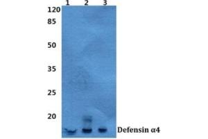 Western blot analysis of Defensin alpha 4 antibody at a 1/500 dilution.