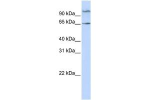 WB Suggested Anti-NET1 Antibody Titration: 0. (NET1 anticorps  (Middle Region))