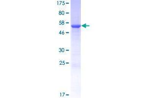 Image no. 1 for tRNA-YW Synthesizing Protein 3 Homolog (TYW3) (AA 1-259) protein (GST tag) (ABIN1324273)
