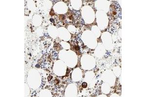 Immunohistochemical staining of human bone marrow with FLNA polyclonal antibody  shows strong cytoplasmic positivity in bone marrow poietic cells at 1:200-1:500 dilution.