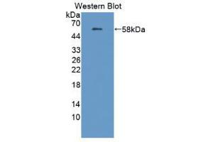 Western blot analysis of the recombinant protein. (Amyloid beta (A4) Precursor Protein-Binding, Family B, Member 1 Interacting Protein (APBB1IP) (AA 188-421) anticorps)