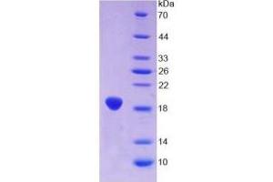 SDS-PAGE of Protein Standard from the Kit (Highly purified E.