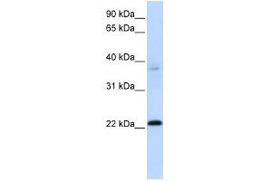 WB Suggested Anti-C11orf74 Antibody Titration: 0. (C11ORF74 anticorps  (Middle Region))