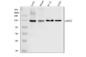 Western blot analysis of TMEM16A using anti-TMEM16A antibody (ABIN6719430).