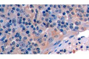 Detection of FAS in Human Tonsil Tissue using Polyclonal Antibody to Factor Related Apoptosis (FAS) (FAS anticorps  (AA 22-172))
