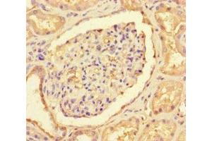 Immunohistochemistry of paraffin-embedded human kidney tissue using ABIN7147089 at dilution of 1:100 (CNOT1 anticorps  (AA 604-867))