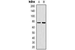Western blot analysis of Rabphilin 3A expression in Hela (A), mouse muscle (B) whole cell lysates.