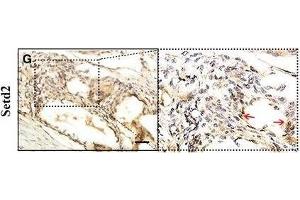 Regenerative potential and expression of hnRNPL, Setd2 and H3K36me3 in the healing of bone defects filled with MBG and Sr-MBG.