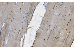 IHC analysis of MEK5/MAP2K5 using anti-MEK5/MAP2K5 antibody (ABIN7602630). (MAP2K5 anticorps  (AA 9-442))