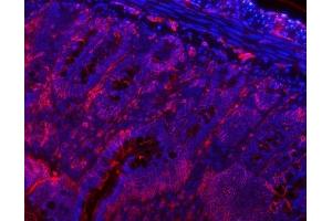 IF analysis of VAPA using anti-VAPA antibody (ABIN7603249). (VAPA anticorps  (N-Term))