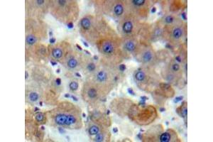 Used in DAB staining on fromalin fixed paraffin-embedded Liver tissue (ACTC1 anticorps  (AA 156-368))