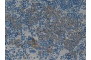 Detection of PAI2 in Rat Spleen Tissue using Monoclonal Antibody to Plasminogen Activator Inhibitor 2 (PAI2)