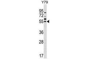FDXR Antibody (C-term) western blot analysis in Y79 cell line lysates (35µg/lane).