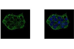 ICC/IF Image EPB41L3 antibody [C3], C-term detects EPB41L3 protein at cytoplasm by confocal immunofluorescent analysis. (EPB41L3 anticorps  (C-Term))