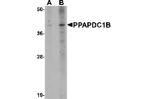 Western blot analysis of PPAPDC1B in EL4 cell lysate with PPAPDC1B antibody at (A) 1 and (B) 2 µg/mL. (PPAPDC1B anticorps  (N-Term))