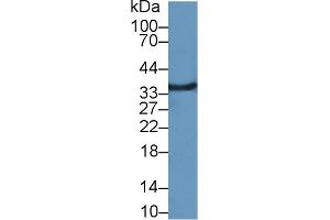 Detection of MFAP4 in Rat Kidney lysate using Polyclonal Antibody to Microfibrillar Associated Protein 4 (MFAP4)