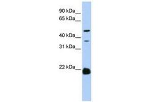 Image no. 1 for anti-Zinc Finger, DHHC-Type Containing 14 (ZDHHC14) (AA 108-157) antibody (ABIN6740780) (ZDHHC14 anticorps  (AA 108-157))